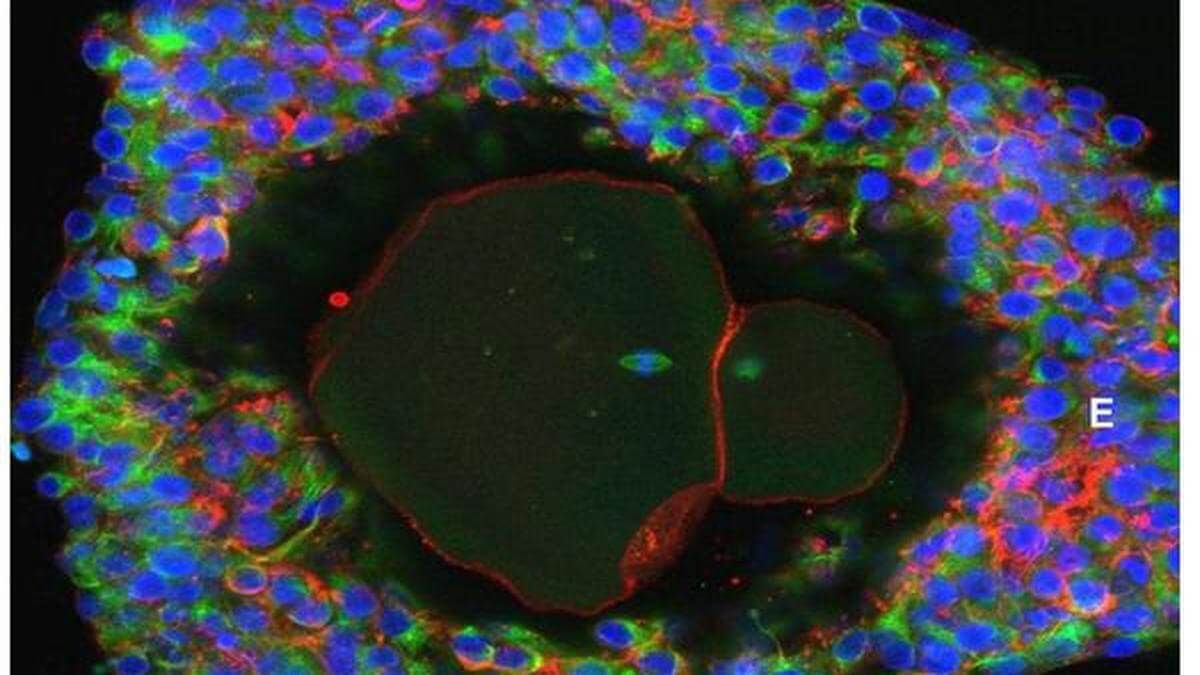 fertility breakthrough growing human eggs in a lab in Albuquerque, NM fertility breakthrough growing human eggs in a lab in Albuquerque, NM